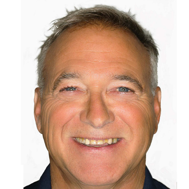 Before.jpg Before.jpg