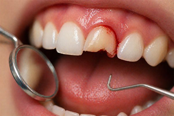 Emergency-Dental-Care.